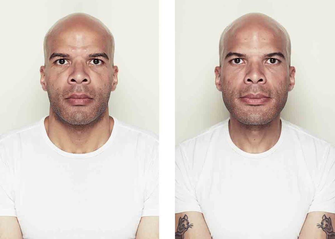 Does Facial Symmetry Define Beauty?