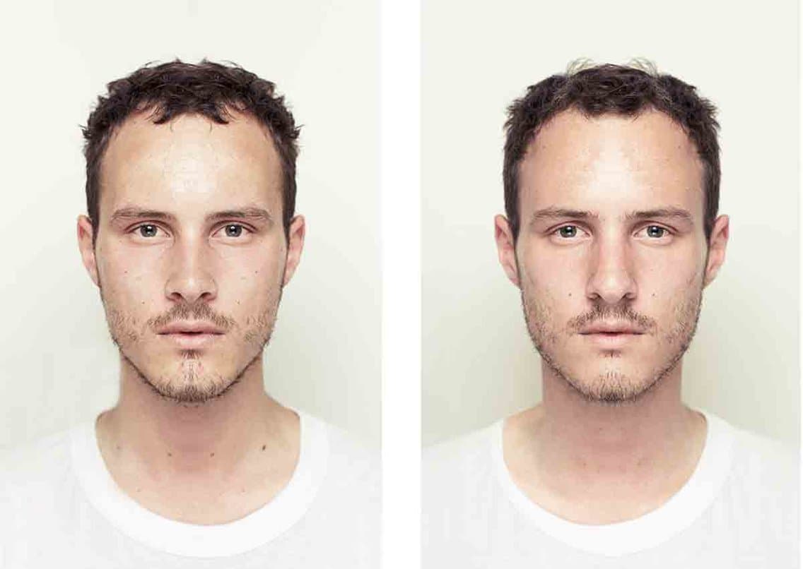 Does Facial Symmetry Define Beauty?