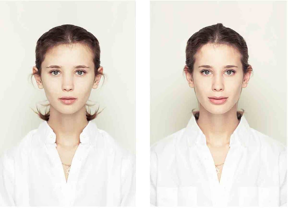 Does Facial Symmetry Define Beauty?