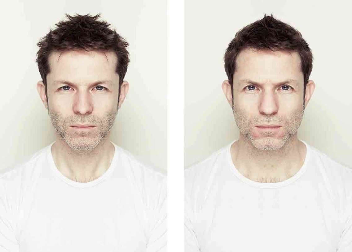 Does Facial Symmetry Define Beauty?
