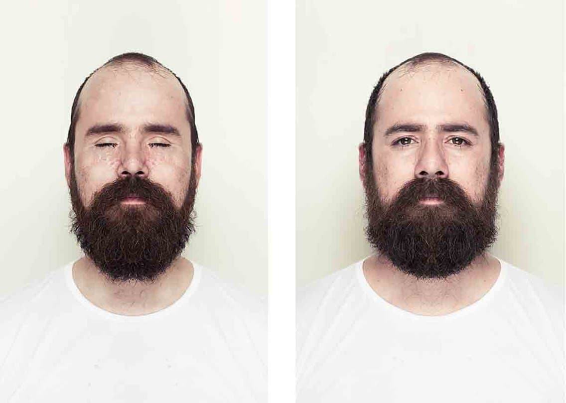 Does Facial Symmetry Define Beauty?