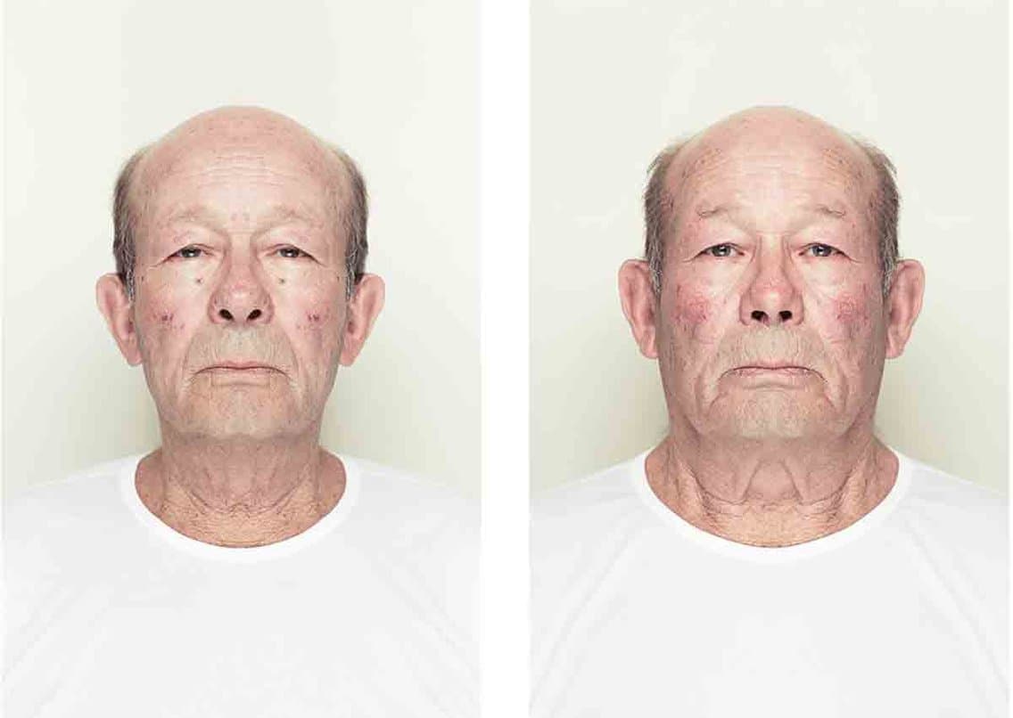 Does Facial Symmetry Define Beauty?