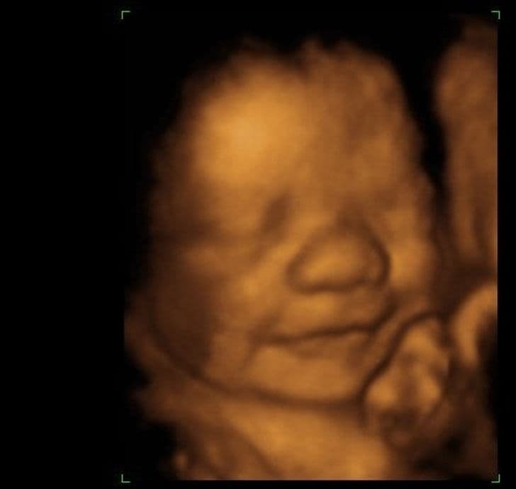 Babies smile even before they are born