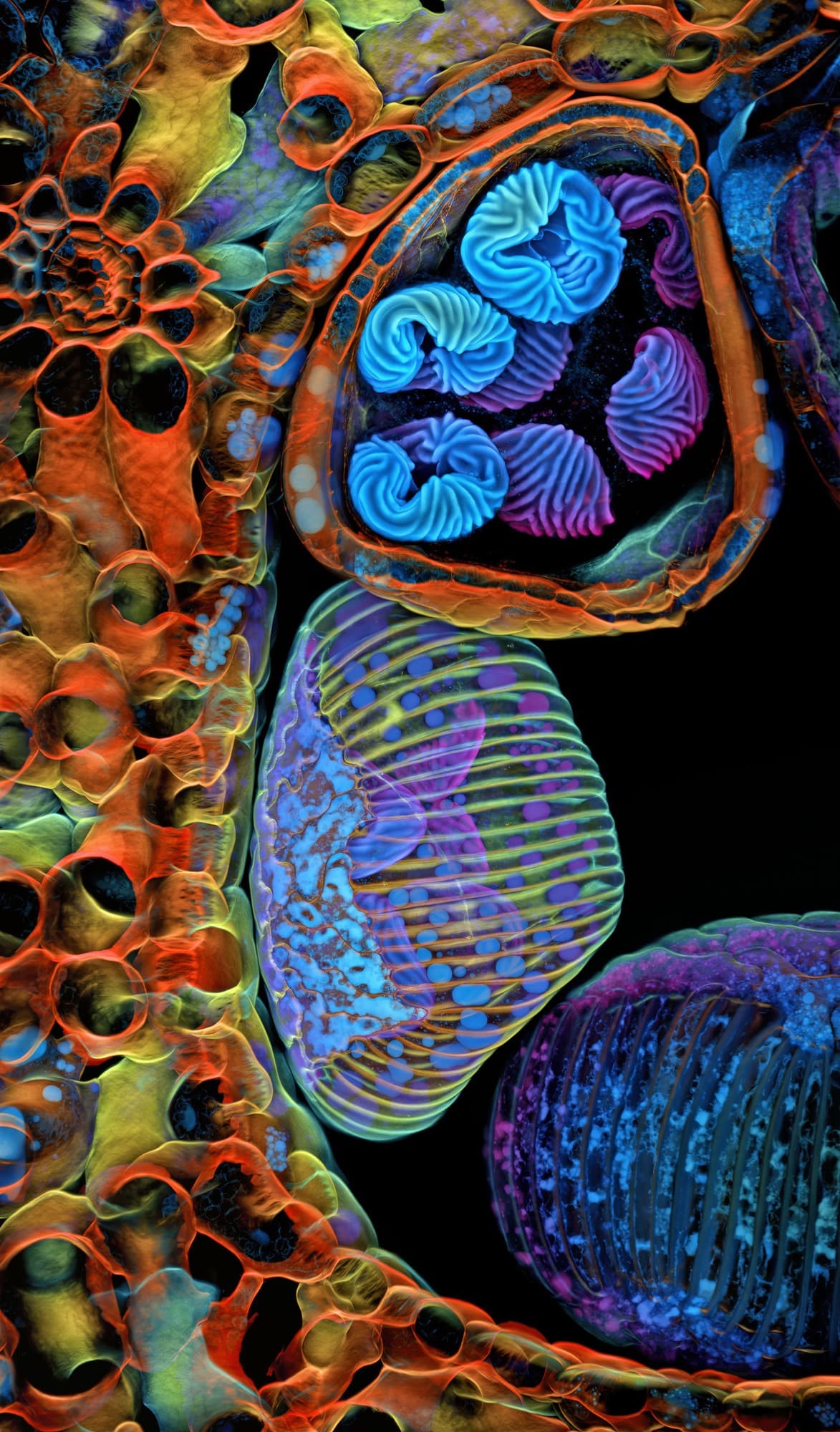 The Sculpted Spores of a Tropical Fern