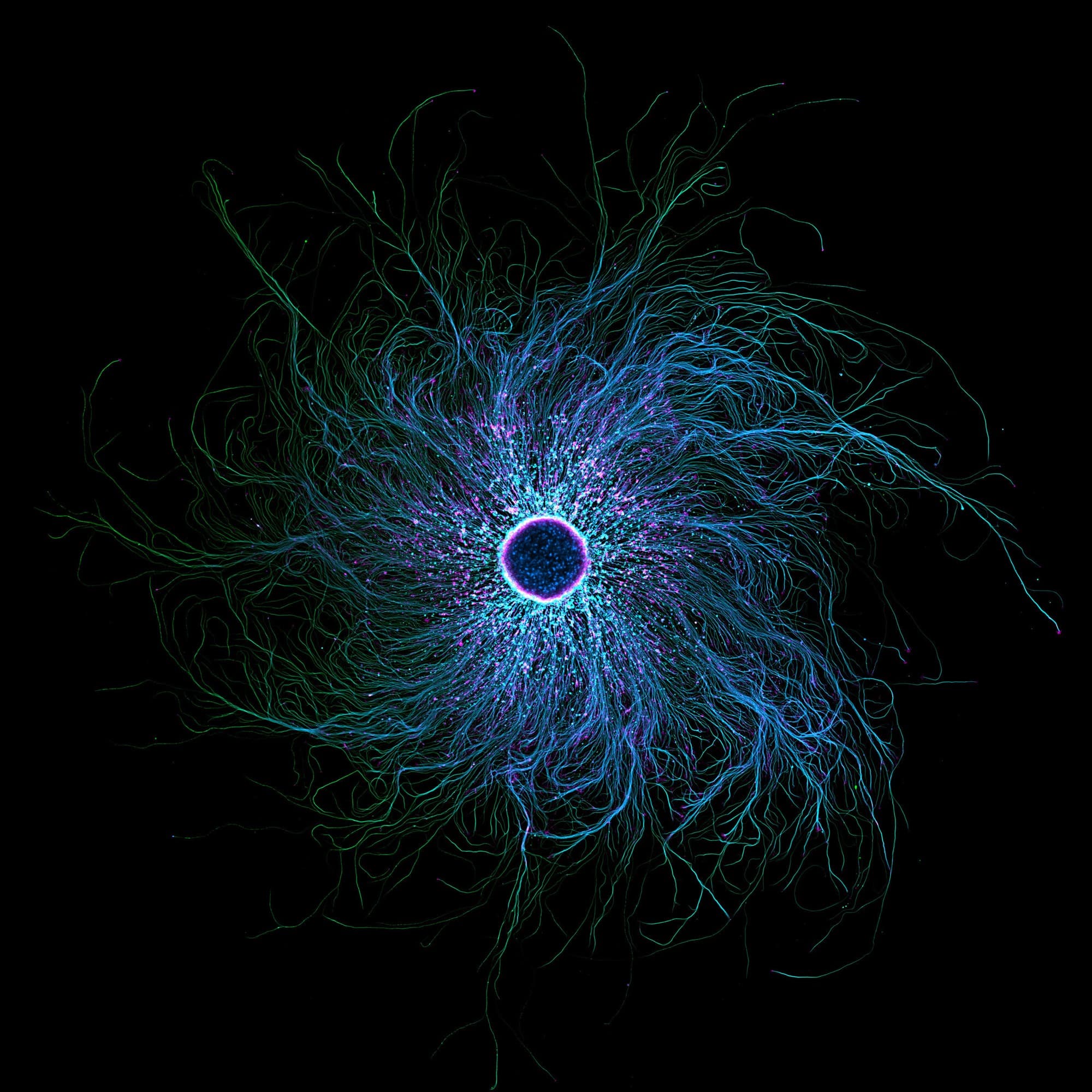 A Neuron’s Radiating Network
